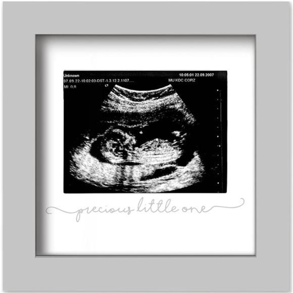 Baby Sonogram Picture Frame - Pregnancy Announcement Photo Frames(Cloud Gray) - Picture 1 of 6